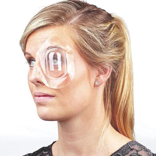 Ein Augenklappen Uhrglasverband der von einer blonden Frau mit zusammengebundenen Haaren getragen auf ihrem Auge getragen wird.jpg